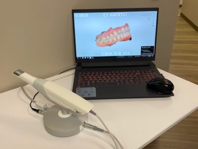 digital inta oral scanning 