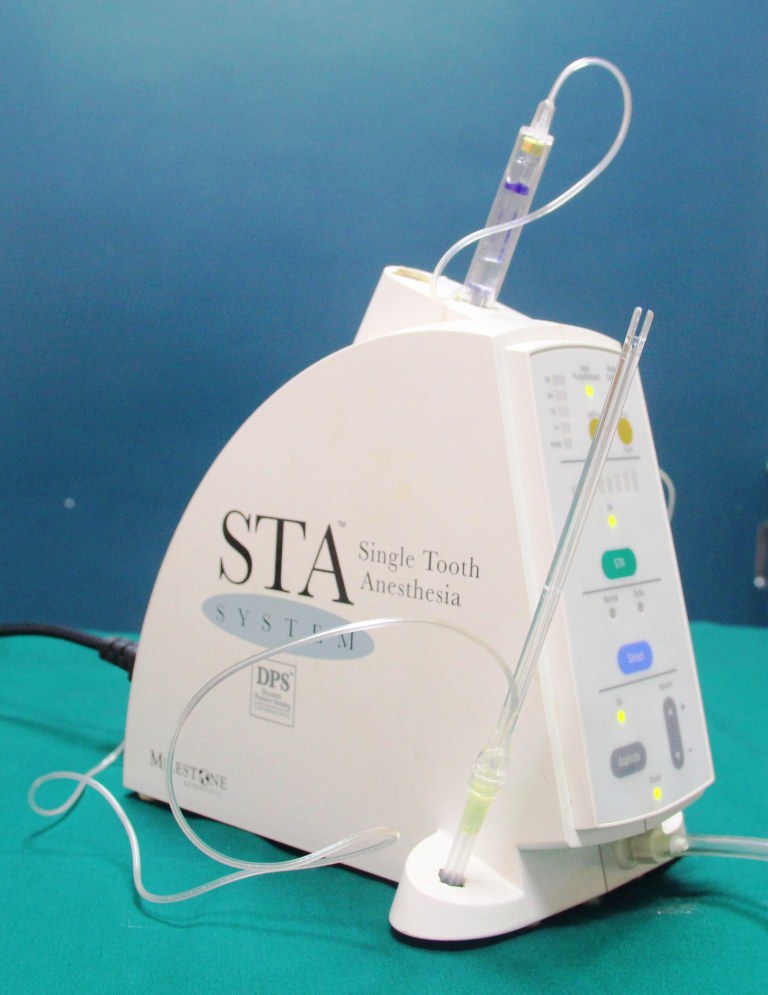 Painless dental treatment with STA anesthetic procedure