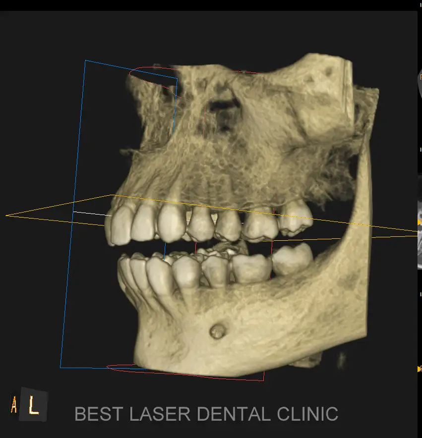 CBCT