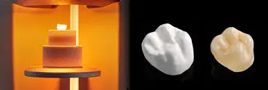 cad cam zirconia crown 