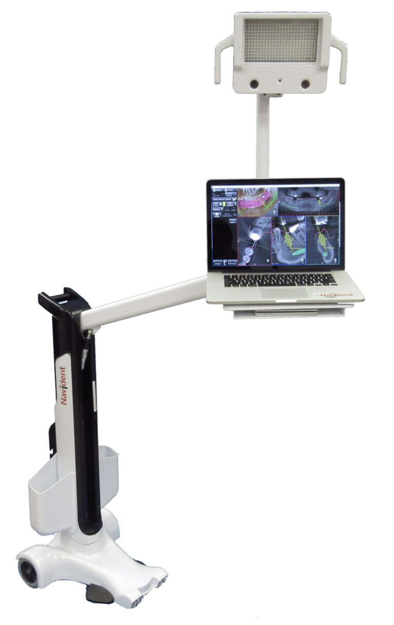 » Dynamic Navigation Implant Surgery